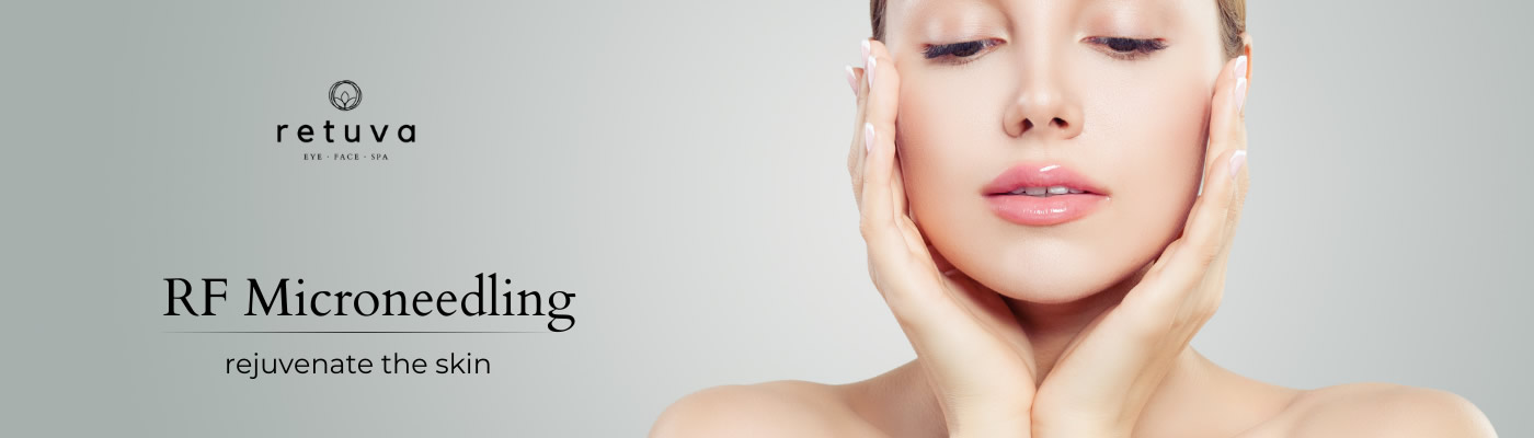 RF Microneedling